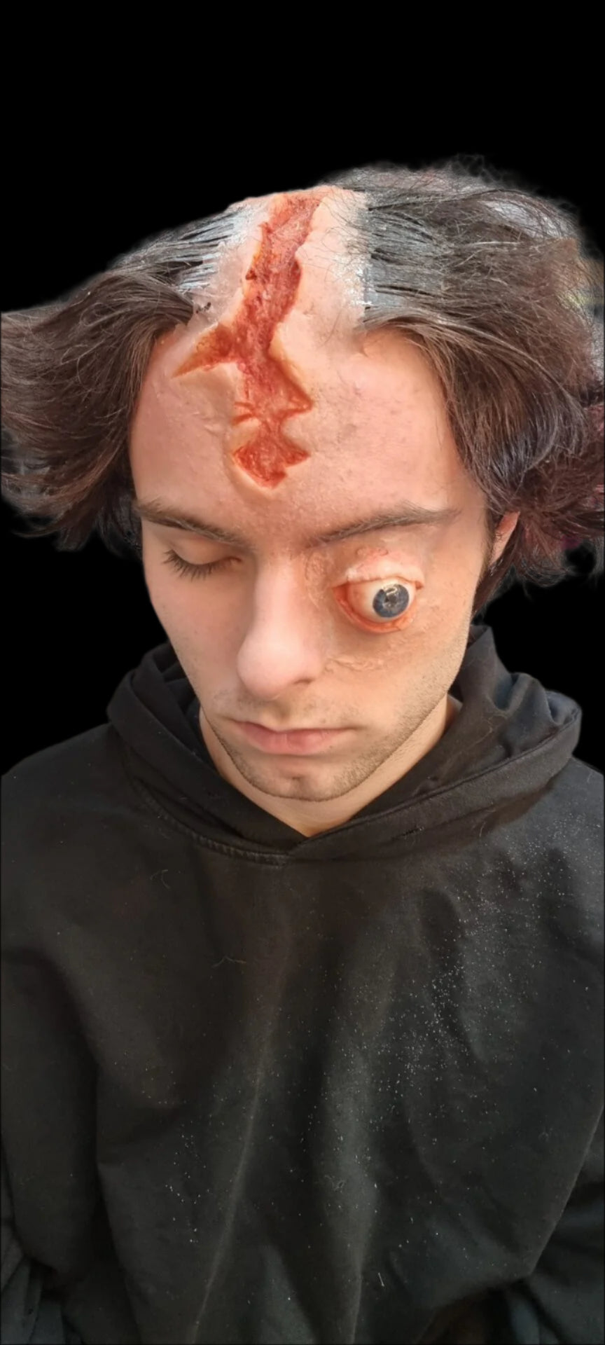 Eye and Head Wound