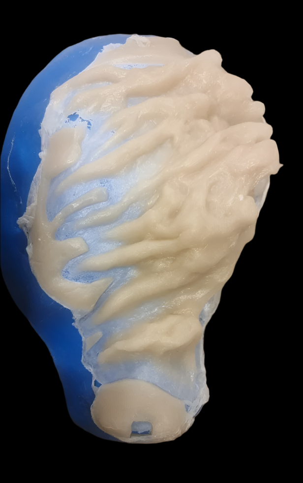 silicone head prosthetic