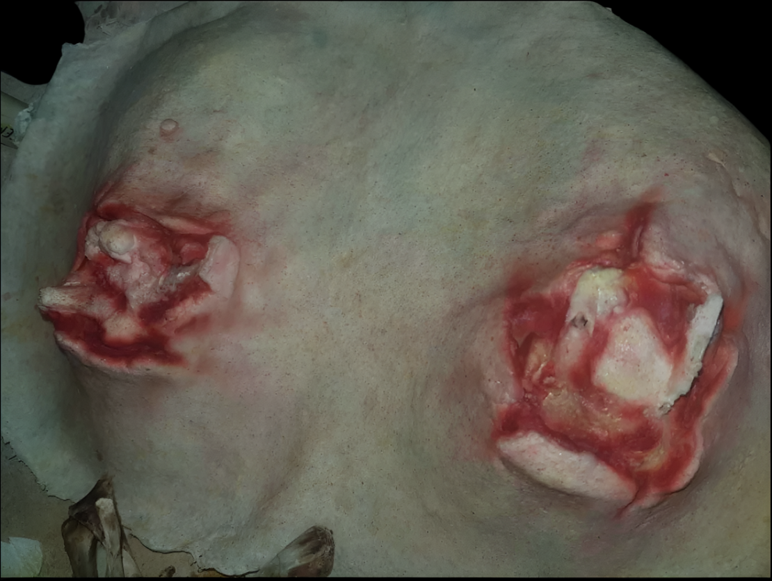 Broken Angel Wings / Bones prosthetic