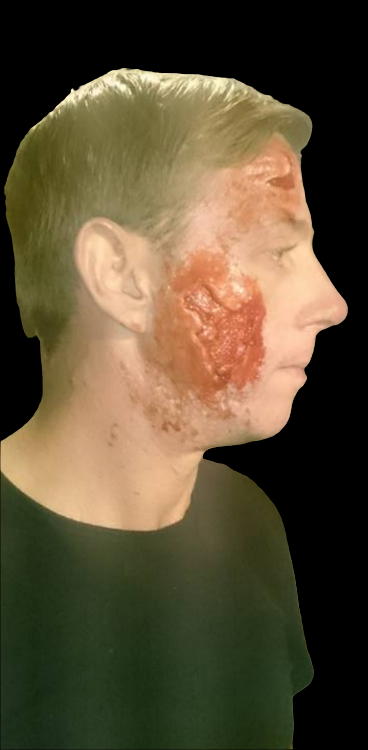 a set of 3 prosthetic wound injury silicone pieces