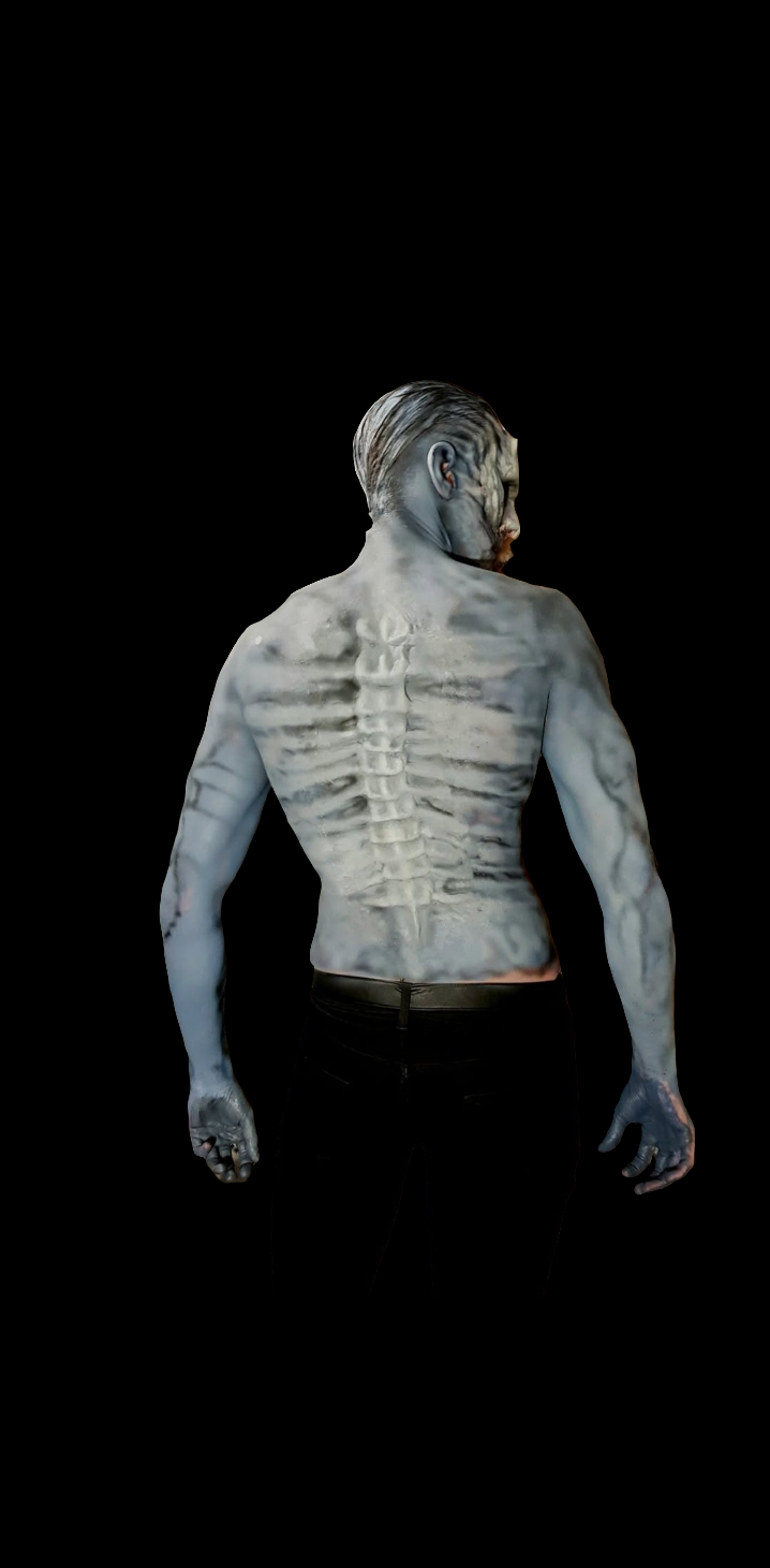 DECAY SKELETAL CHEST AND SPINE