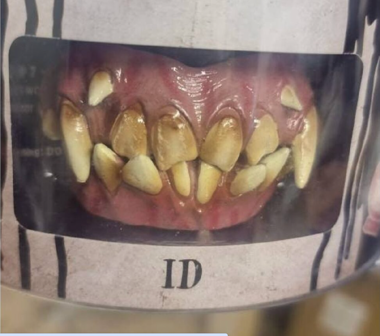 faux ID teeth