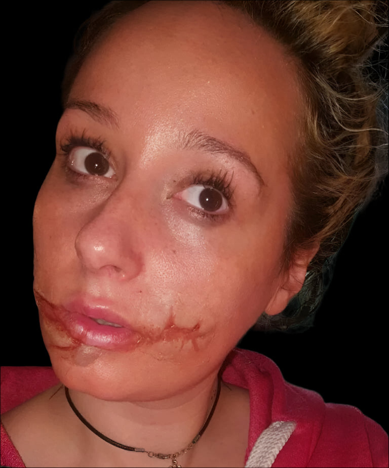 joker smile slash wound prosthetic