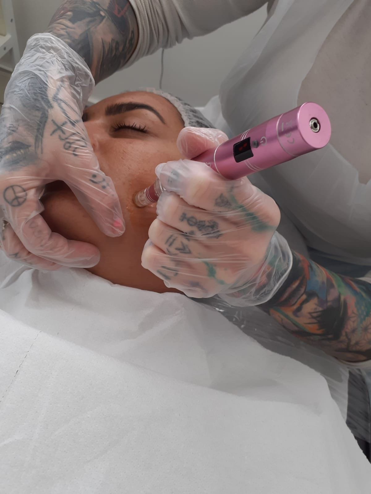 microneedling course workshop