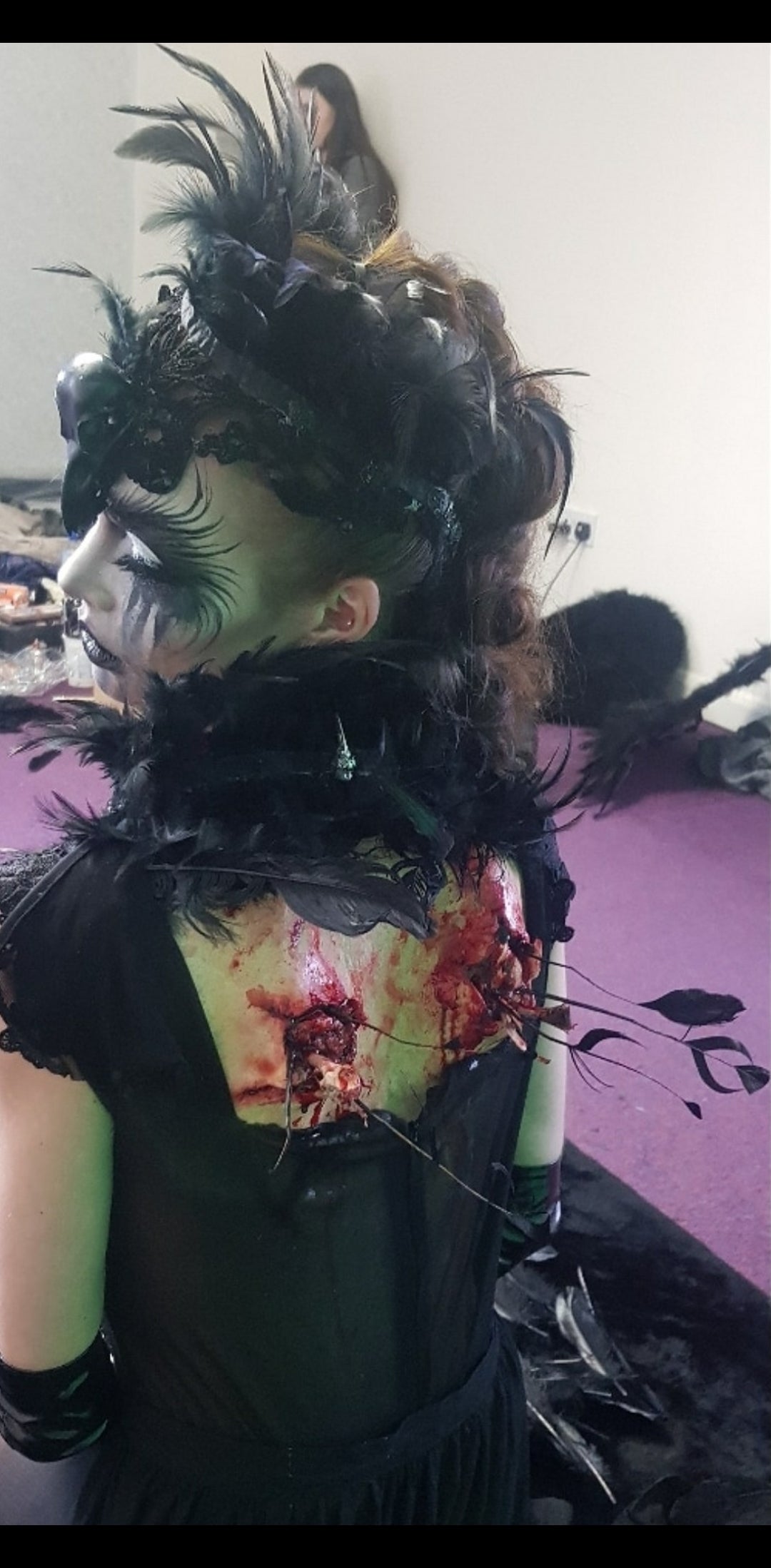 Broken wings prosthetic