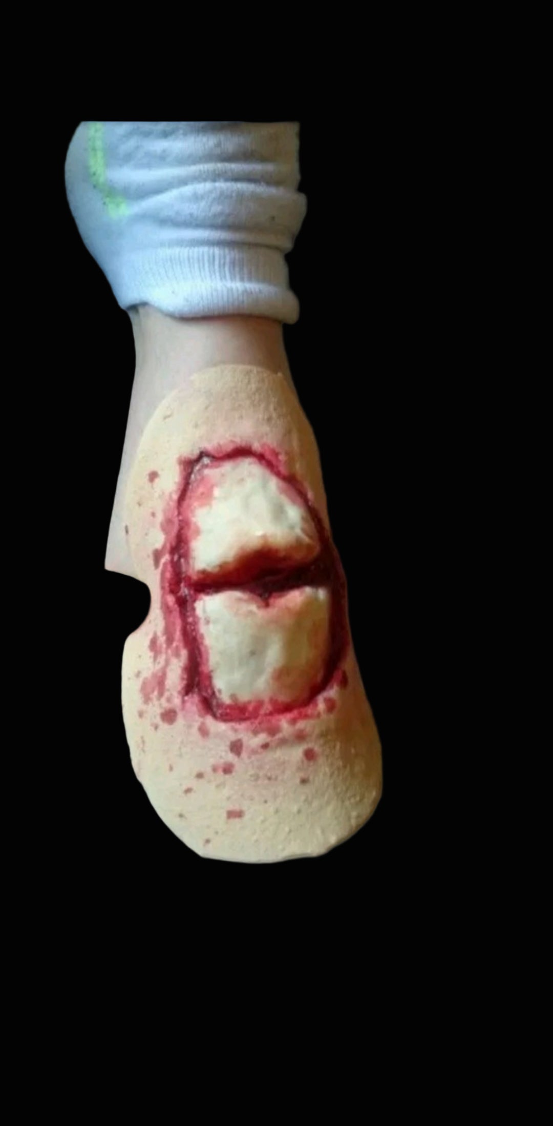broken bone latex prosthetic.