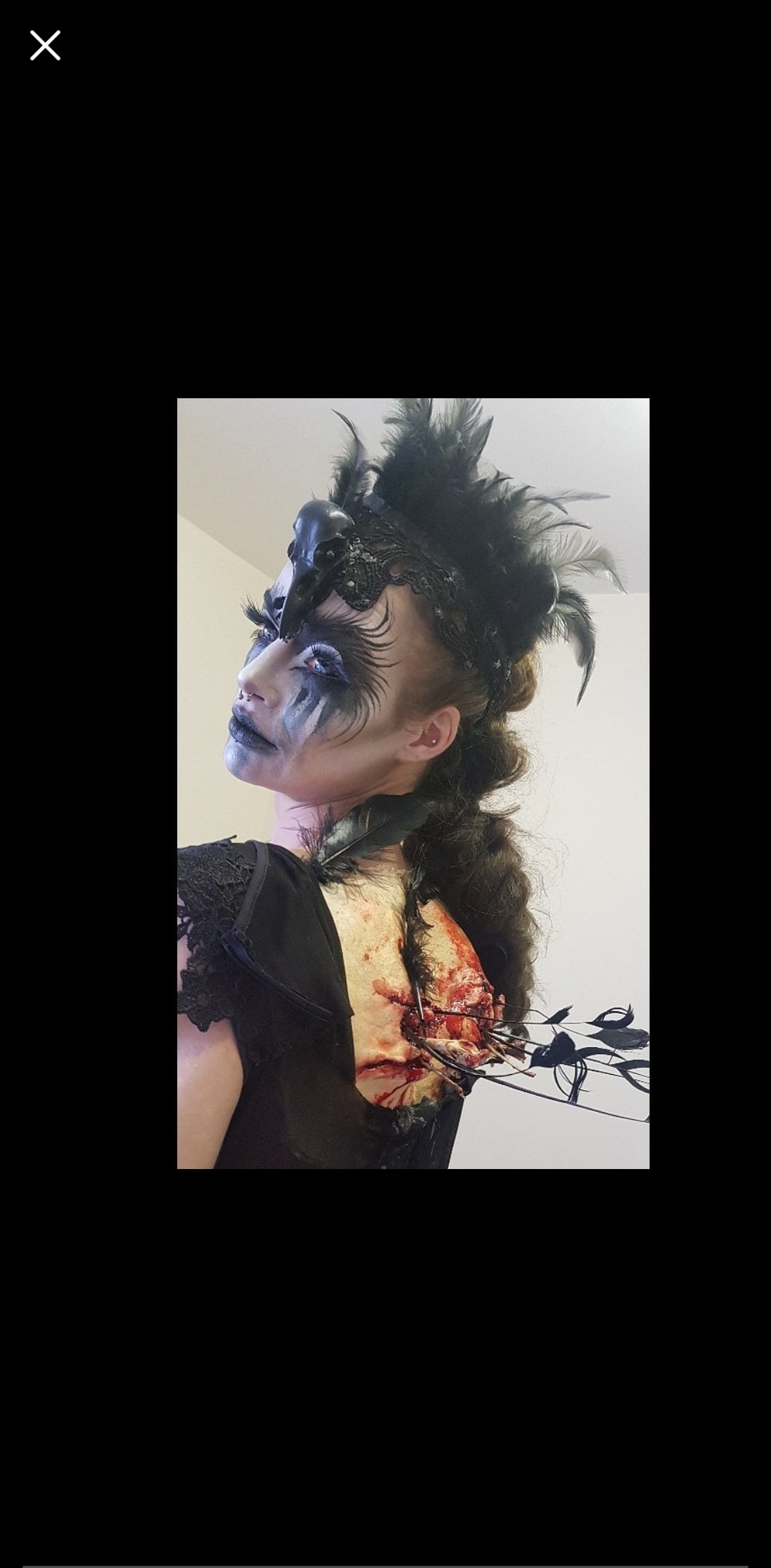 Broken wings prosthetic