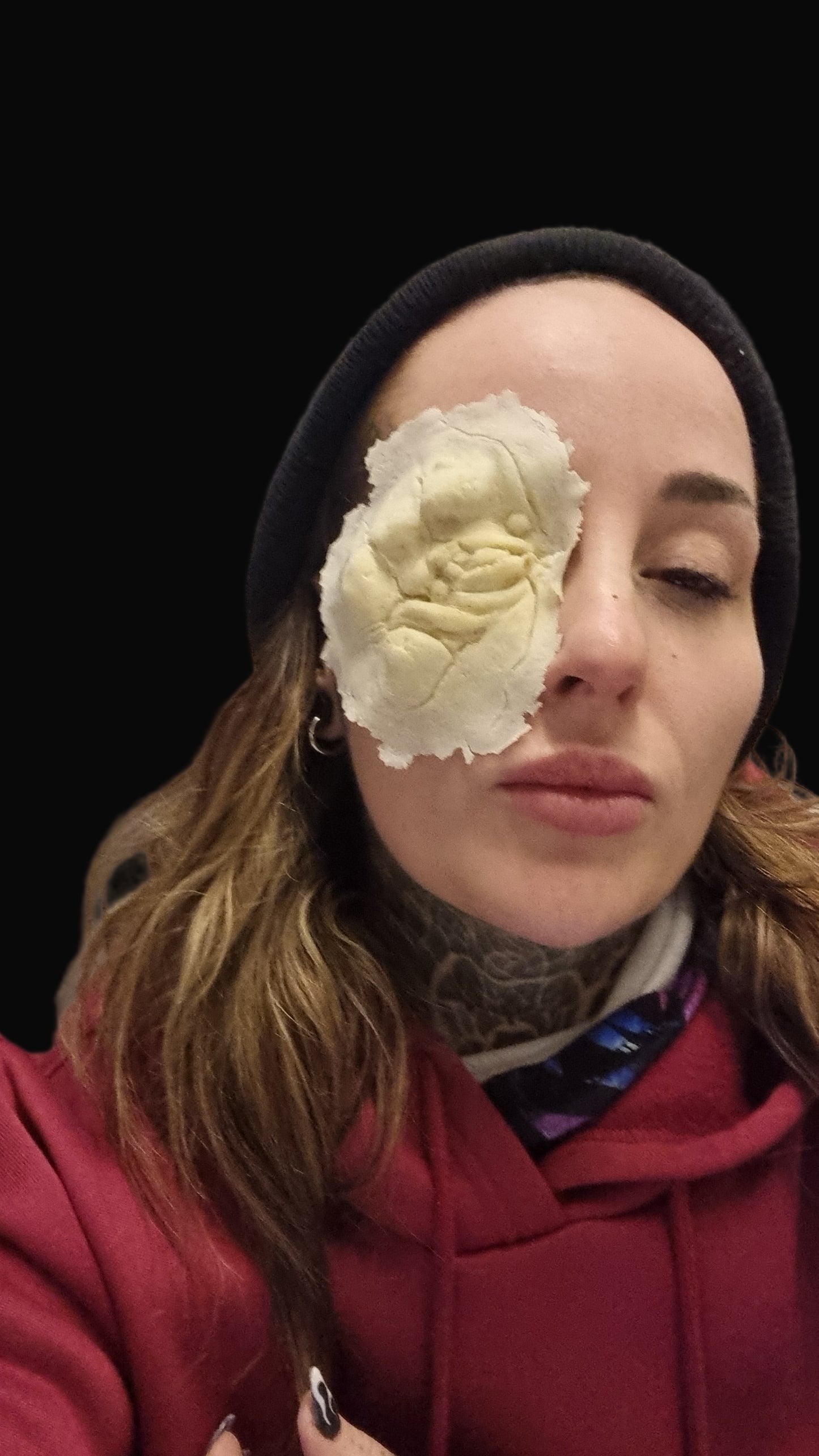 Blinded eye wound prosthetic