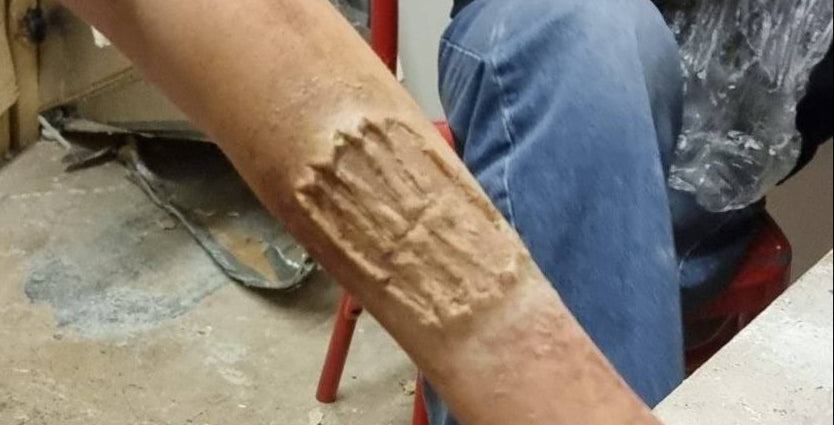zombie prosthetic bite