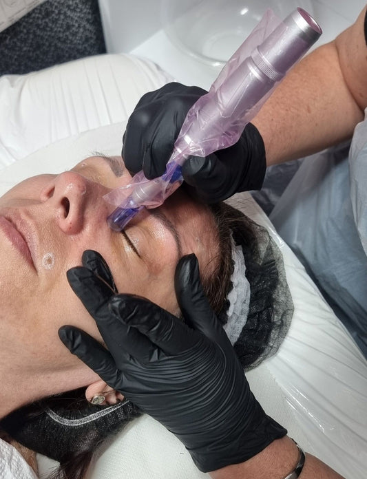 accredited microneedling course at ko studio