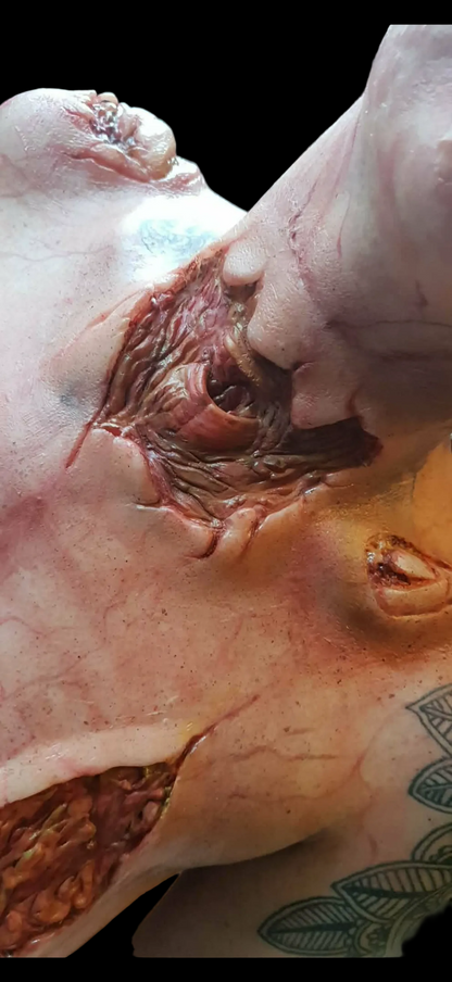 EXPOSED NECK WOUND