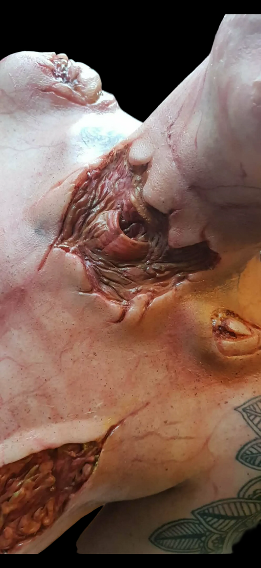 EXPOSED NECK WOUND