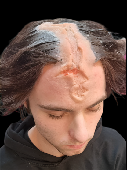 head wound 