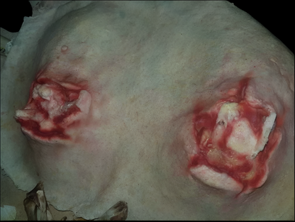 Broken Angel Wings / Bones prosthetic 