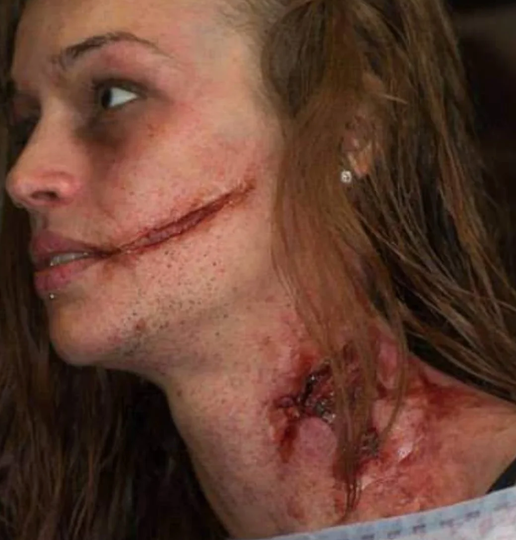 Subtle Slash Wounds