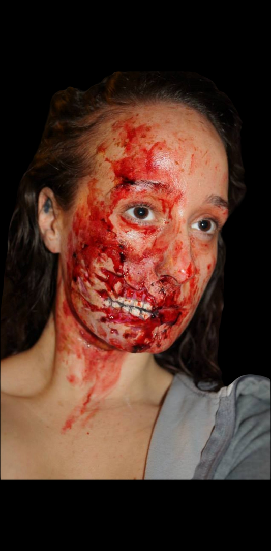 TEETH EXPOSED