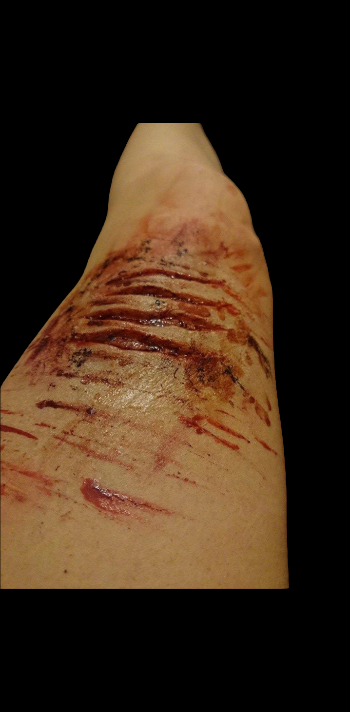 SCRATCHES SET