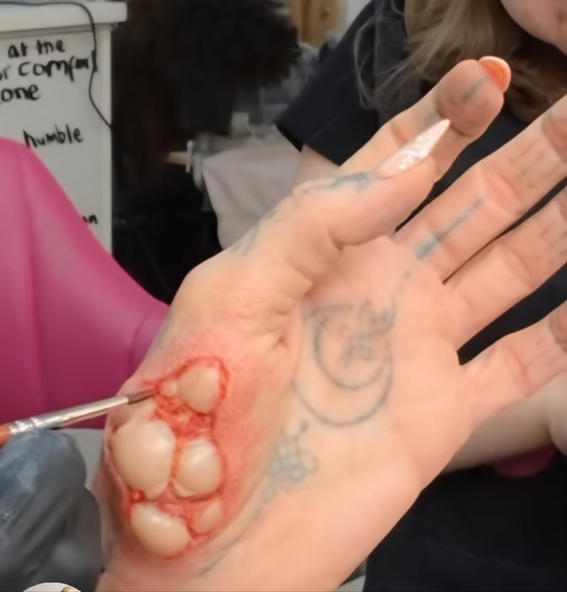 boils flesh wounds zombie exposed tissue muscle wound rip tear injury prosthetic silicone small deep gash wound
