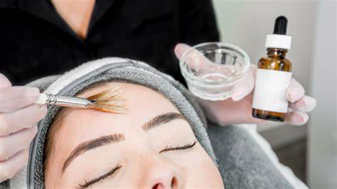 chemical peel accredited course Leicester facial 