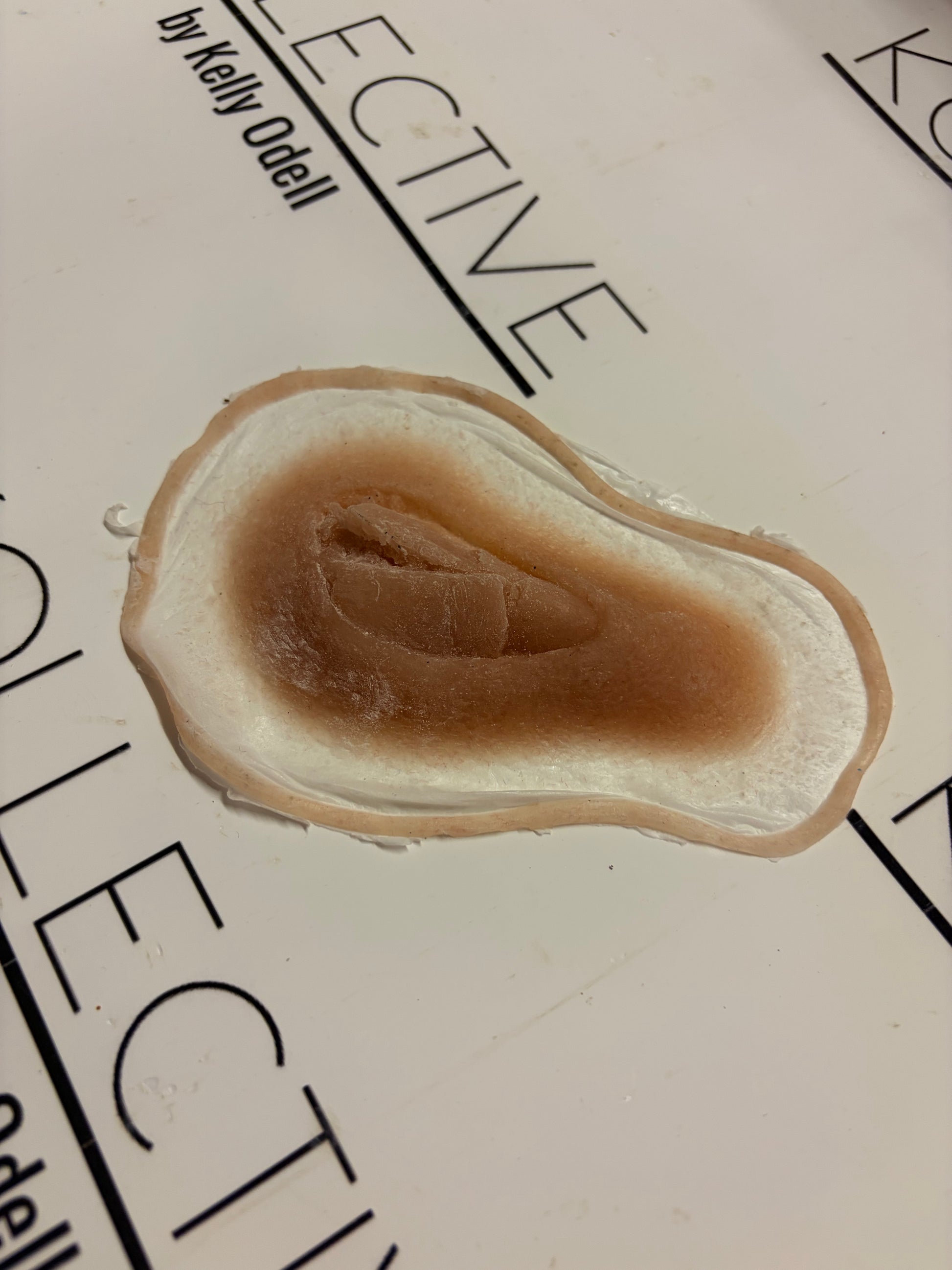exposed bone wound