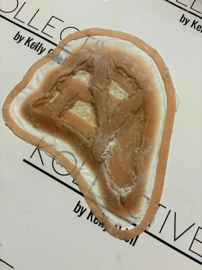 exposed rib cage 