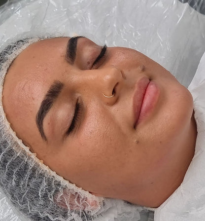 Leicester facial/ skincare packages/ micro needling/ bio peeling/ radio frequency 