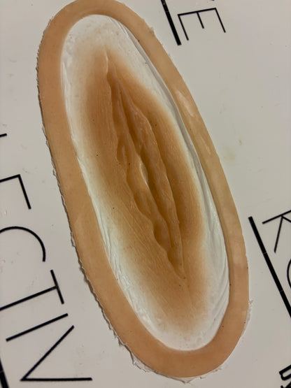 fleshy gash wound