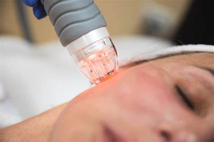 rf fractional needling beauty course accredited course
