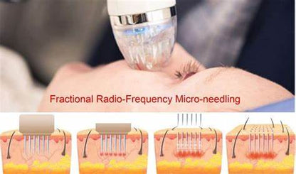 rf fractional needling beauty course accredited course