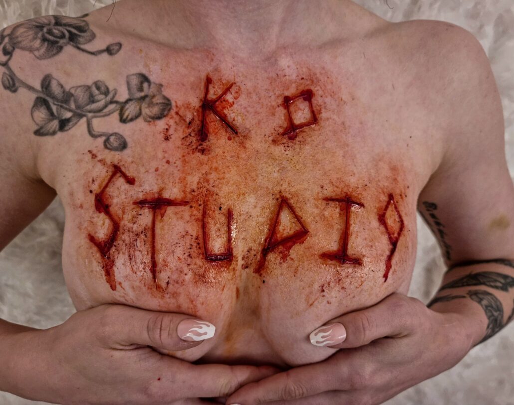 injury Realistic prosthetic application by Leicester special effects makeup artist
