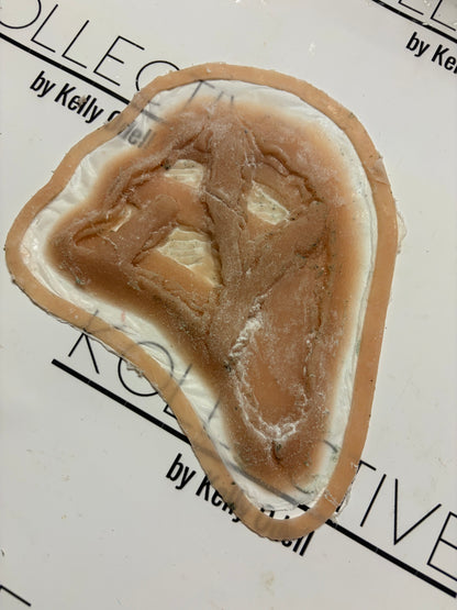 open chest wound