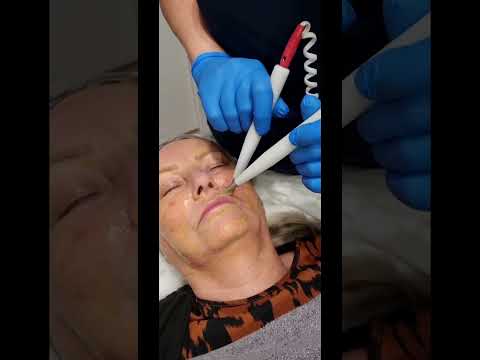 micro current facial courses available Leicester 