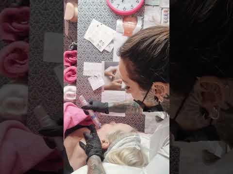 Leicester facial/ skincare packages/ micro needling/ bio peeling/ radio frequency 