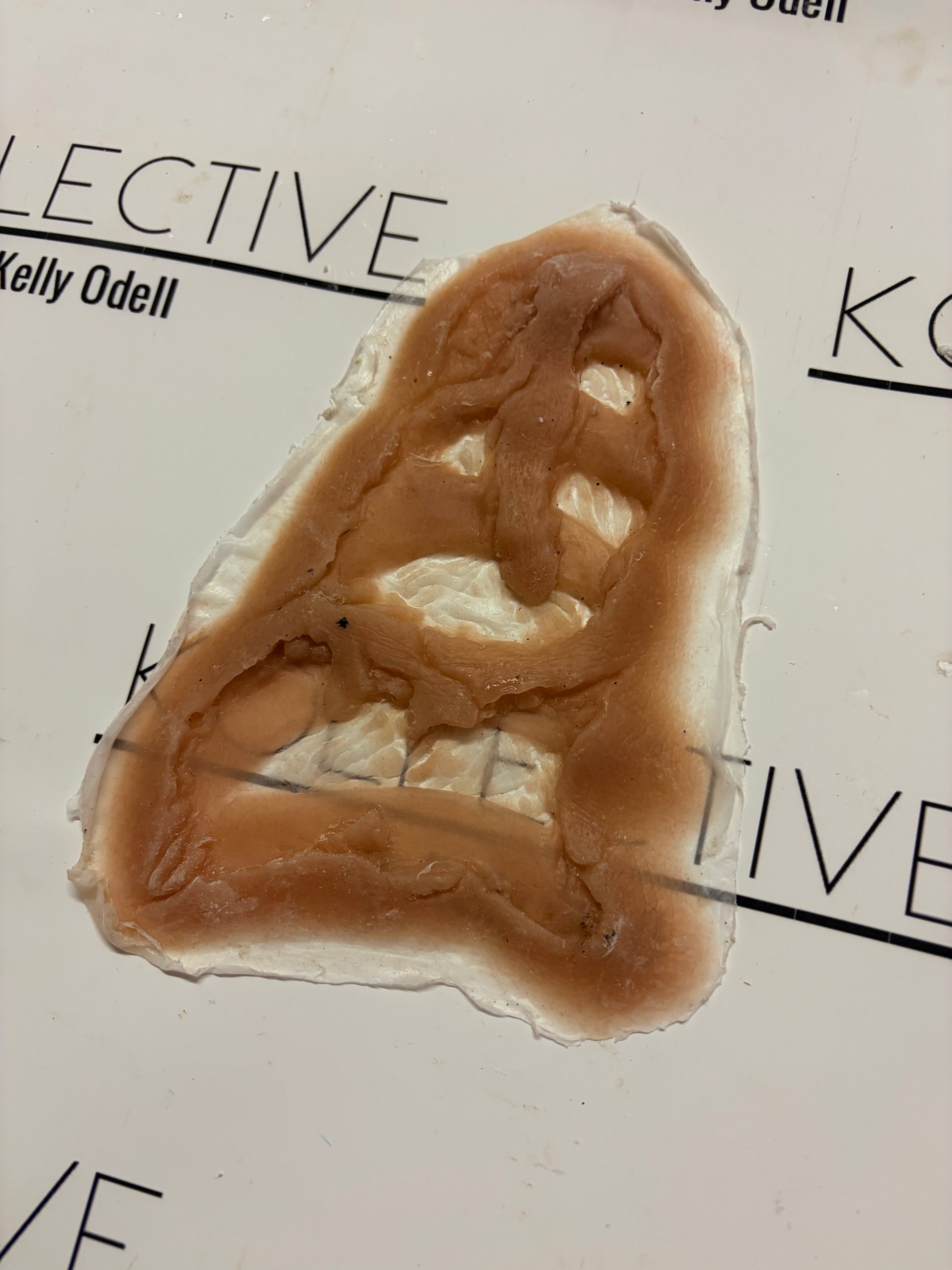 rib cage prosthetic