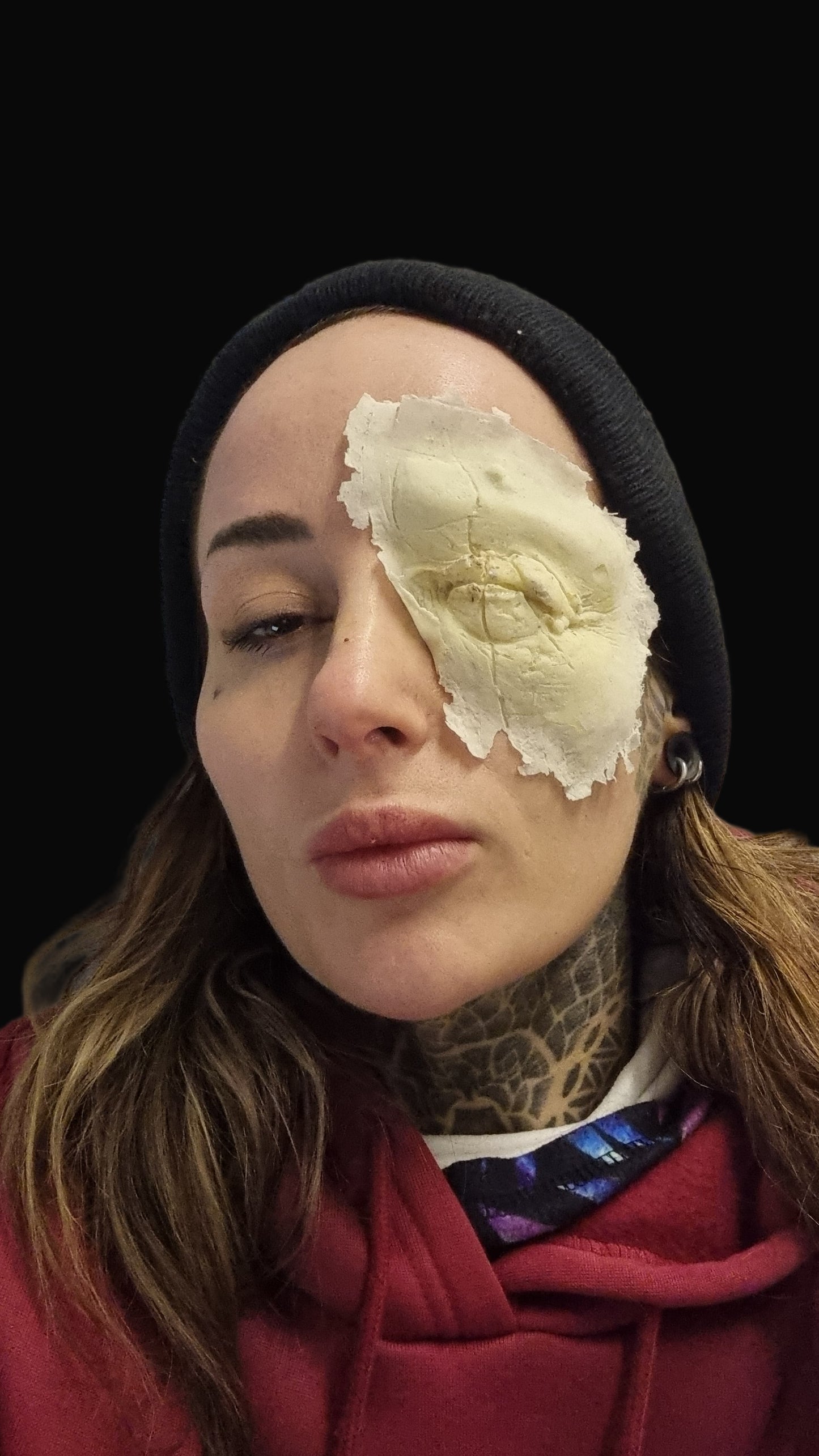 Blinded eye wound prosthetic