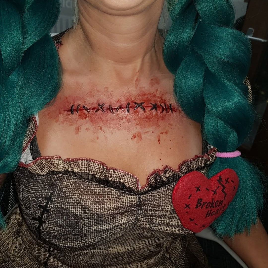 LARGE STITCH WOUND