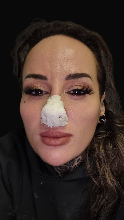 Dog snout prosthetic