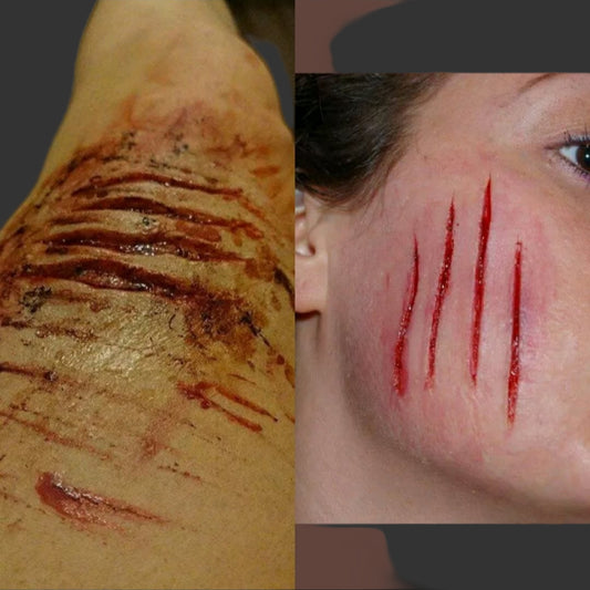 SCRATCHES SET