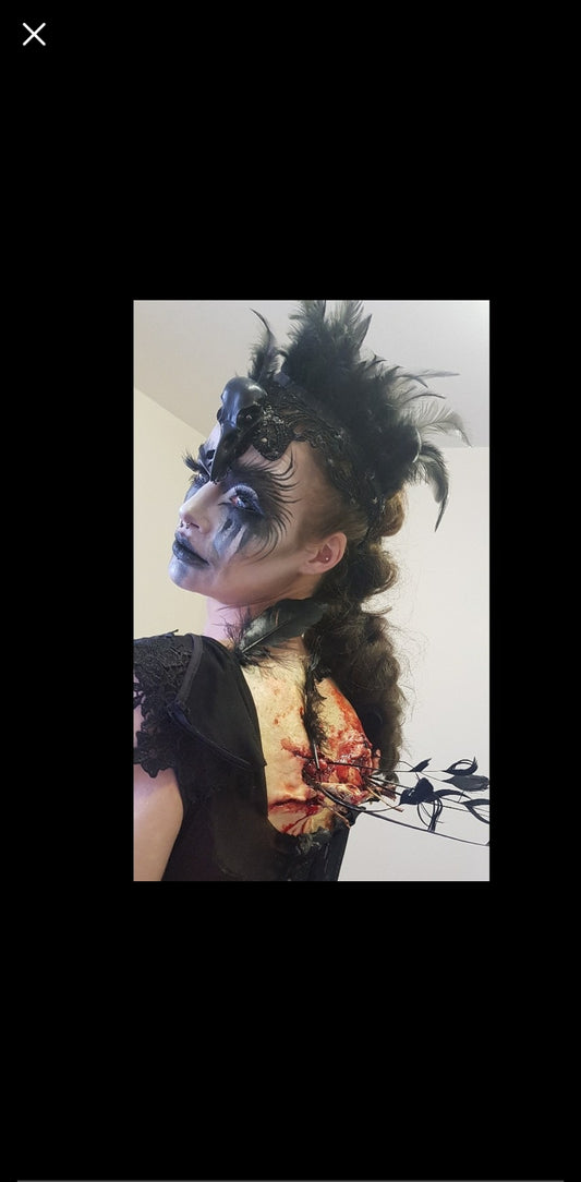 Broken wings prosthetic 