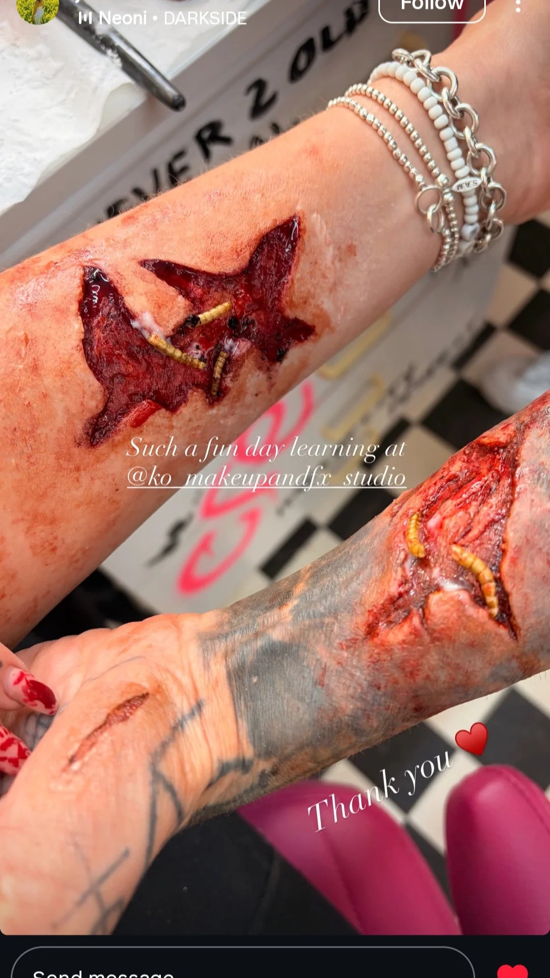 3 PIECE WOUNDS INJURY SET