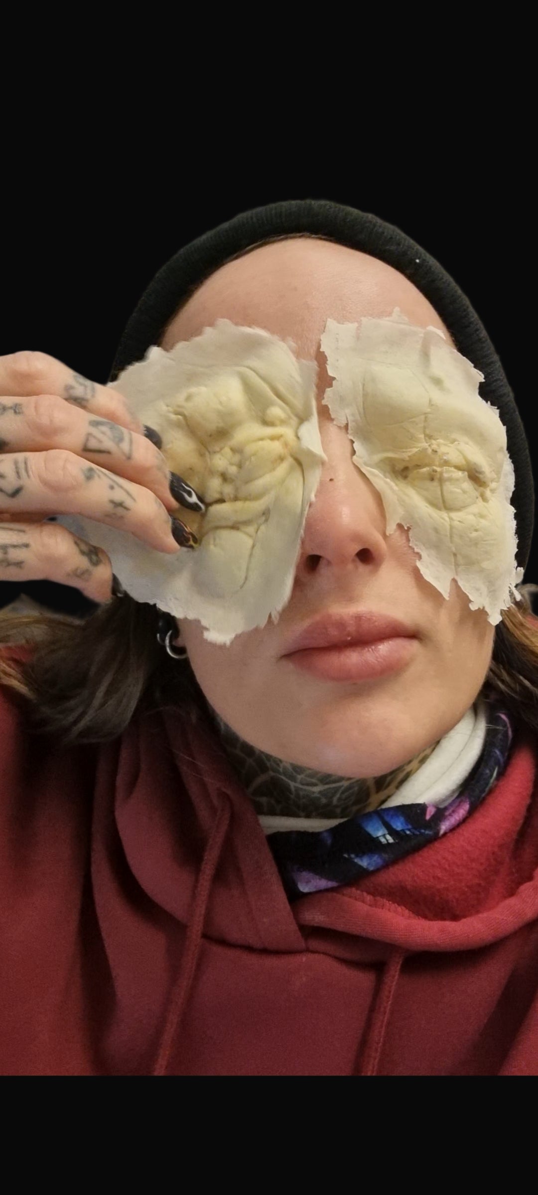 Blinded eye wound prosthetic