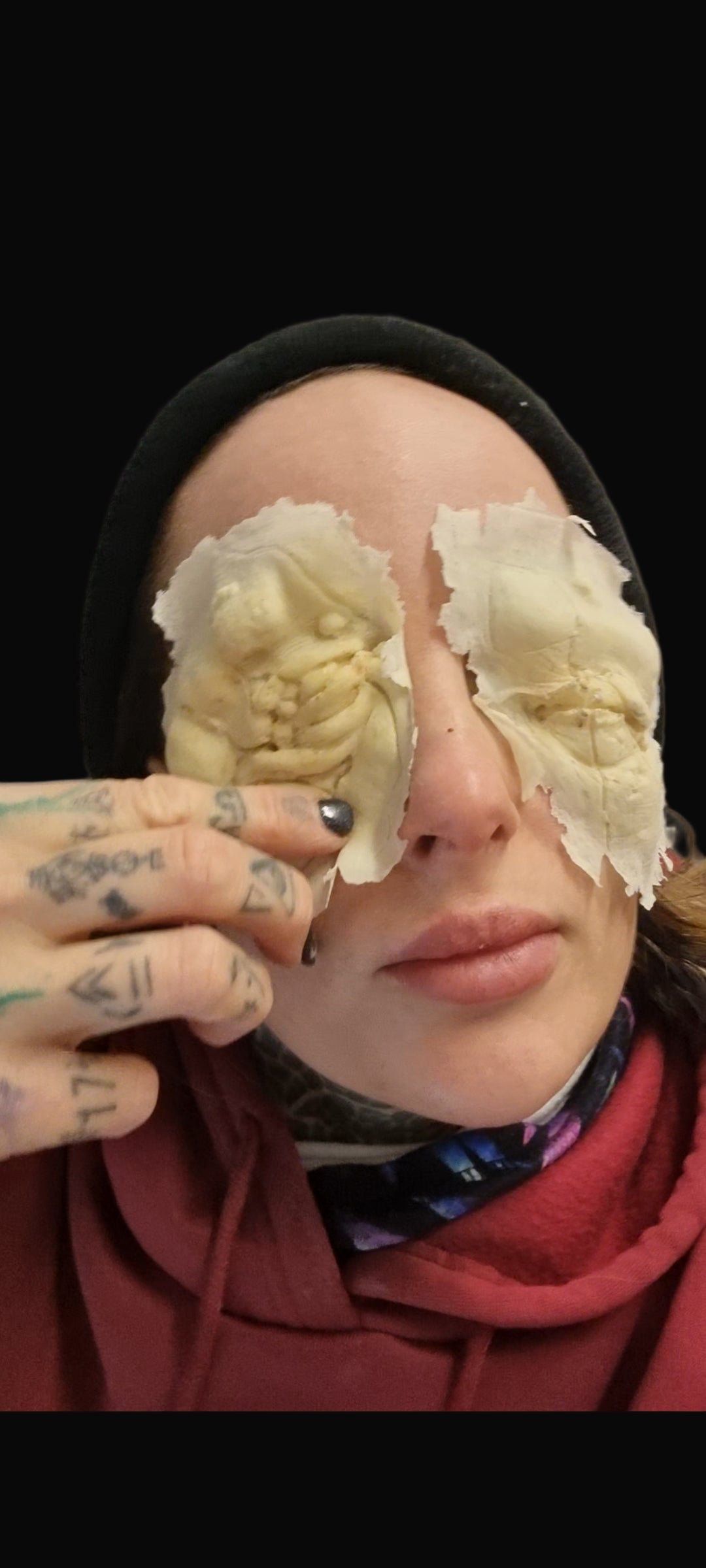 Blinded eye wound prosthetic