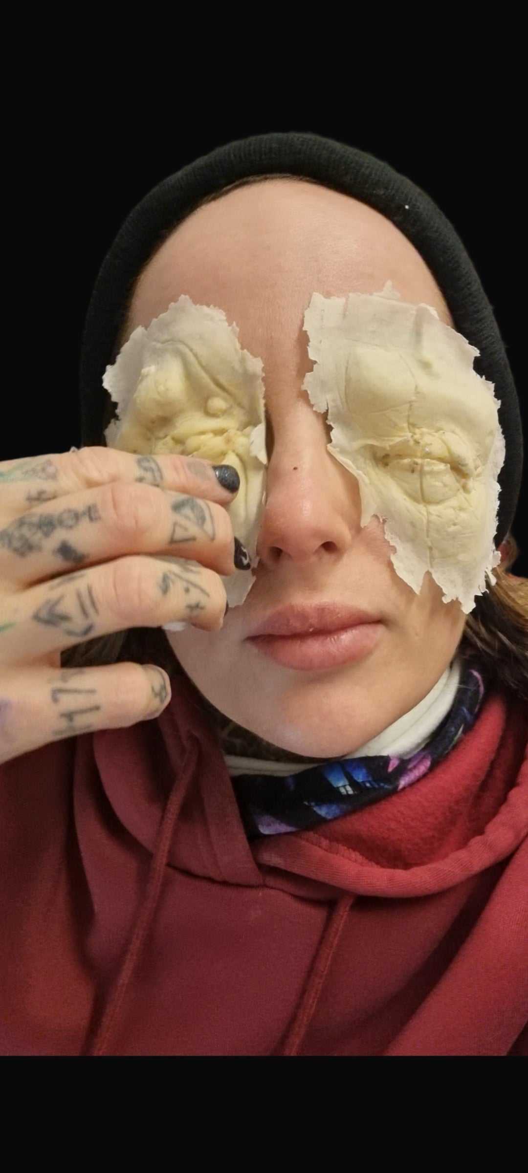 Blinded eye wound prosthetic