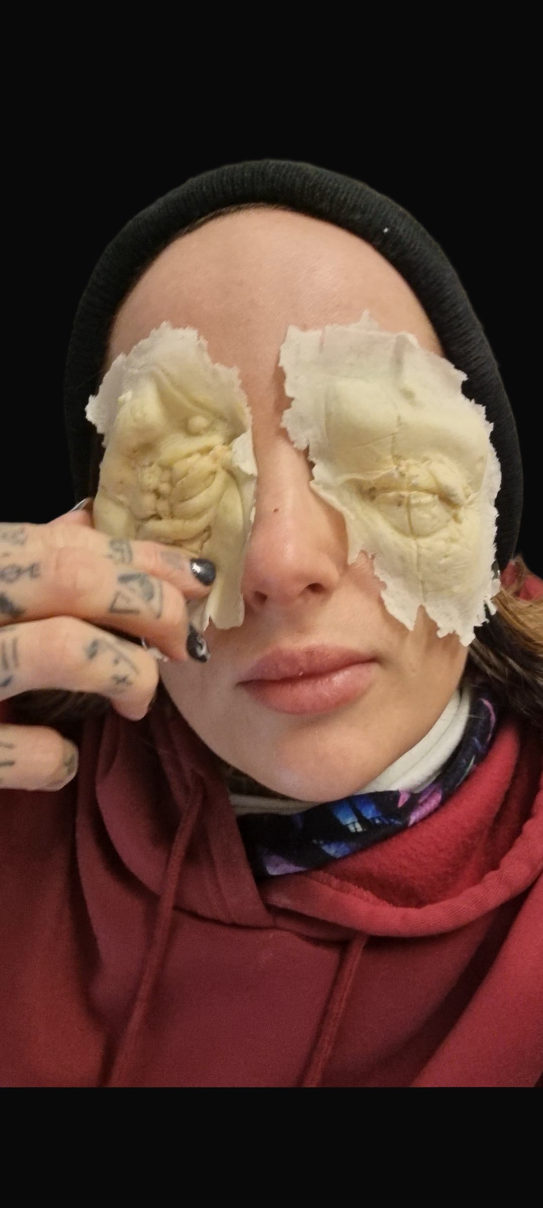 Blinded eye wound prosthetic