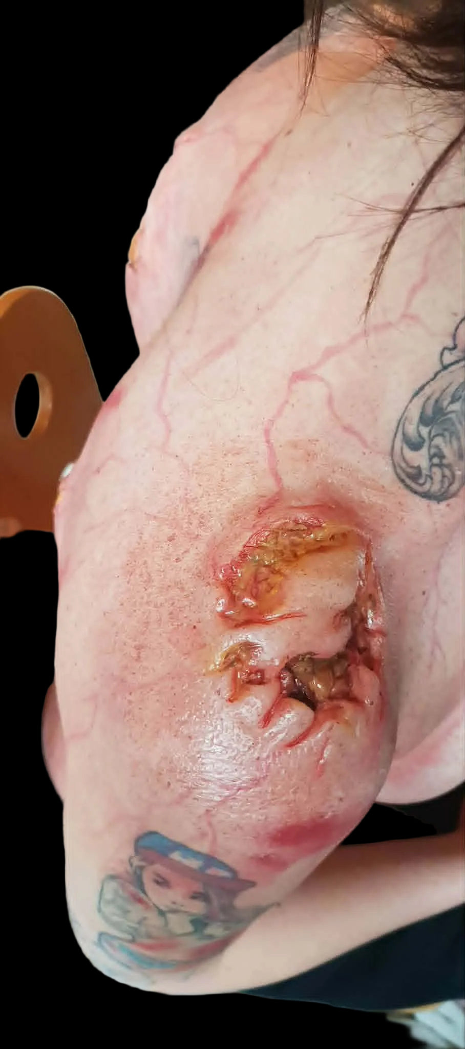 zombie, silicone prosthetics, injury, wound, shop