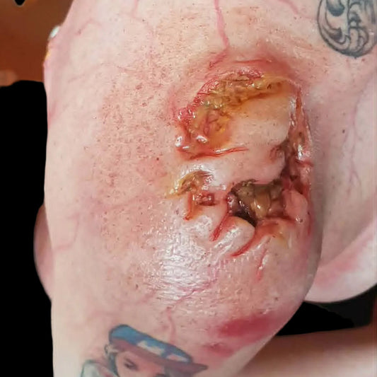 zombie, silicone prosthetics, injury, wound, shop Zombie bite, wound, flesh wound silicone prosthetic by ko studio online shop. cosplay 