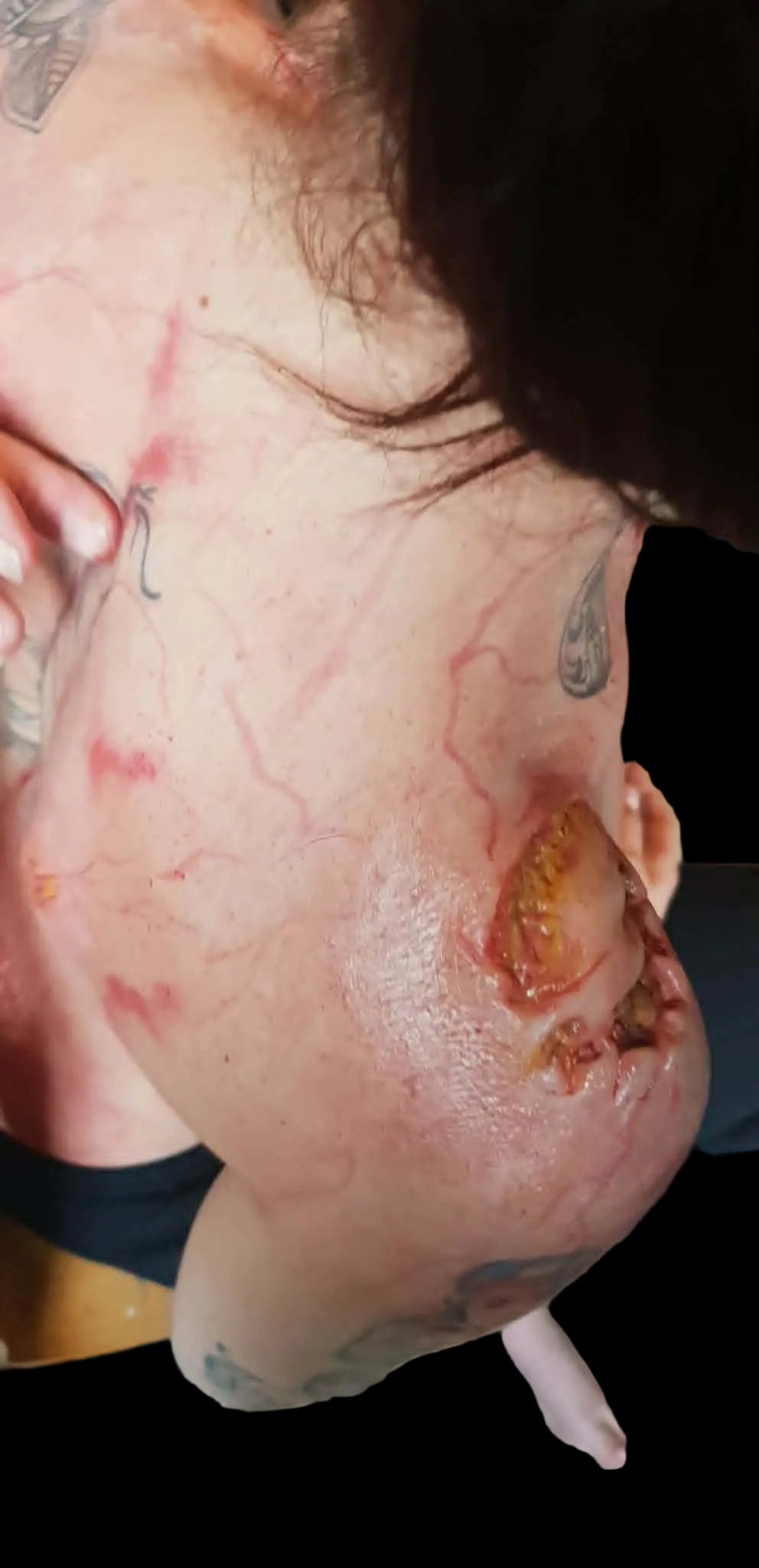 zombie, silicone prosthetics, injury, wound, shop
