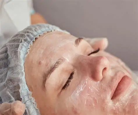 Leicester facial/ skincare packages/ micro needling/ bio peeling/ radio frequency 