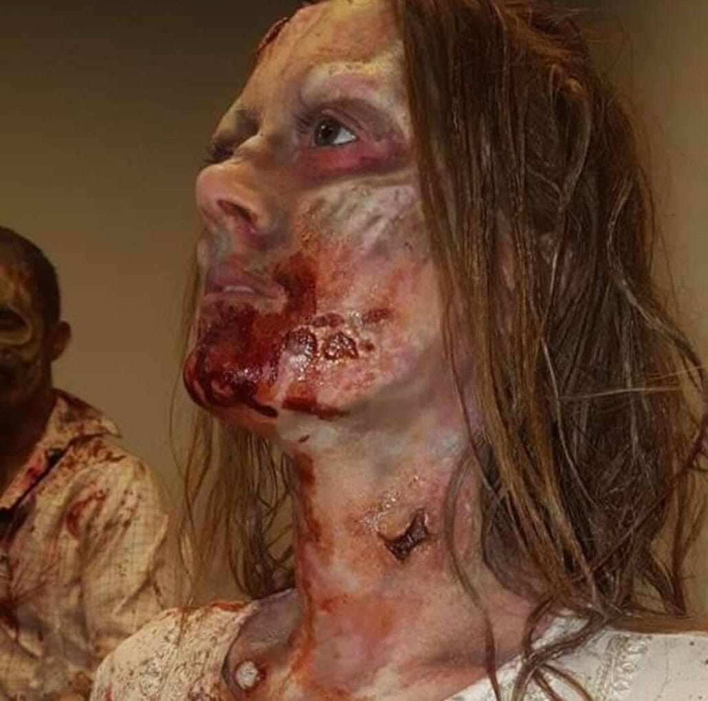 small injury prosthetics