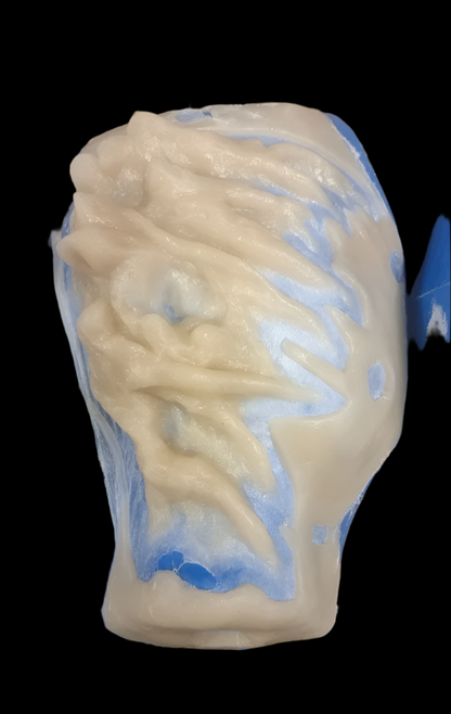 stone-textured ear prosthetics